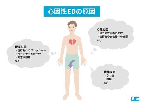 緊張で勃たない|心因性EDとは｜考えられる原因と検討したい4つの解 